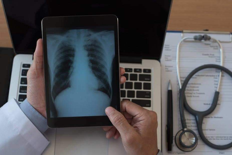 Radio du torse d’un patient reçue sur une tablette numérique. Shutterstock