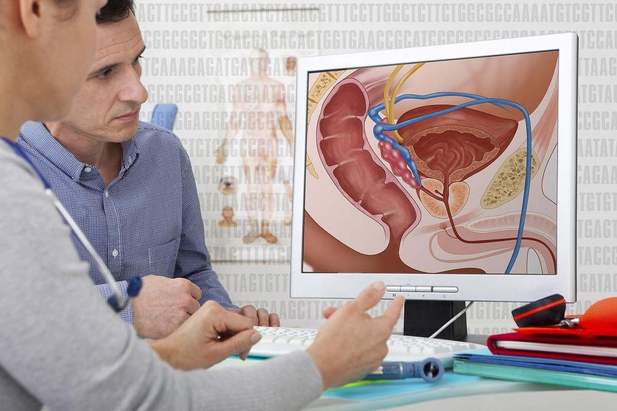 Vessie et prostate (Flickr) Vessie et prostate (Flickr)