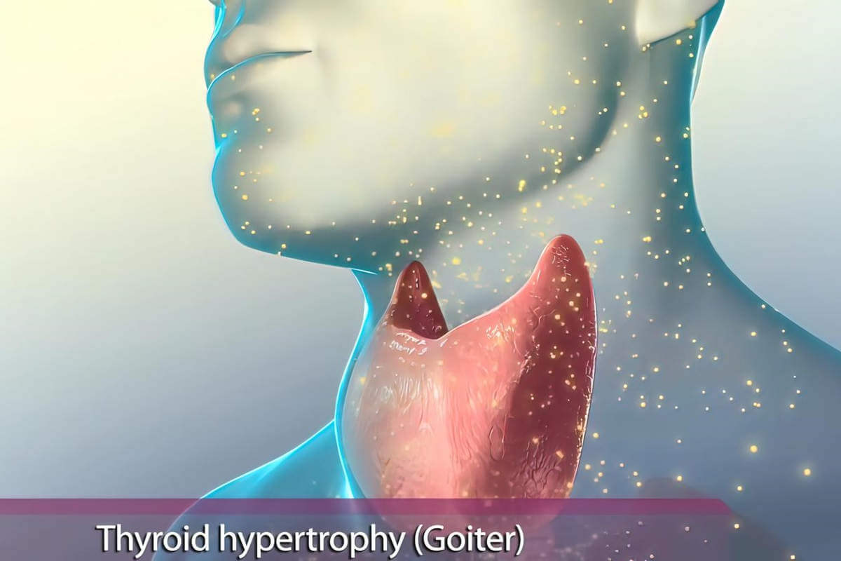 Glande thyroïde (UnlimPhotos)